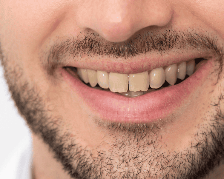 Untitled (750 x 600 px) Untitled (750 x 600 px)