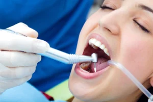 root canal treatment in g8 islamabad